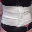 Post op day 8 with compression garment on