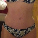 6 months post op
