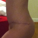 Other side