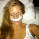 Night after Surgery