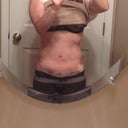 Post op day 8