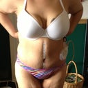 9 days po still have 1 drain.