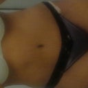 Still swollen 23 days post op