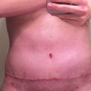 WK 5