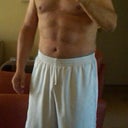 two weeks post surgery
