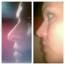 before/3.5 weeks