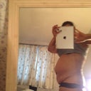 I always have to wear support underwear but it never gets rid of the flap.