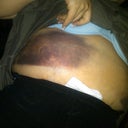 first day right rib cage