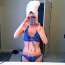 9 days post op
