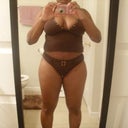 12 Days Post-Op