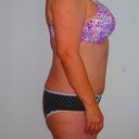 before side view