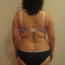 before back view