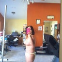 Day 15PO bruising is better and I can stand straighter.