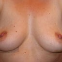 Day 6 after explant