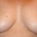 6 weeks after explant
