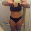 2 months post op