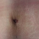 New belly button