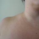 Shoulder Dents