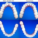 Before and proposed after pics