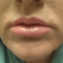 lips after prevelle silk