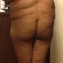 Pre-op: Back (I cannot wait to either get rid of the roles or at least see them smaller.