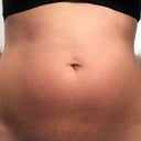Before the surgery