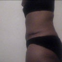 4 months po side view
