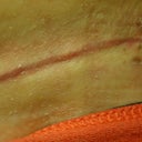Close up of my scar 18 Days PO.