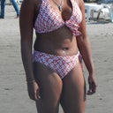 11 weeks post op..still puffy