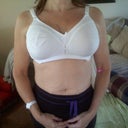12 hours post-op