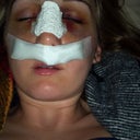 Day after surgery