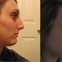 before and after