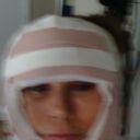 after surgery,not much discomfort