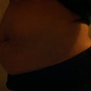 before- side view