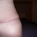 14 weeks 2 days PO......dog ear