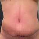 Here you can see the ridge on my waist...in the pic its on the left...