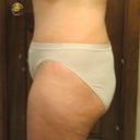 left side 4 weeks