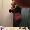 I like Day 19. Still swollen and cement in my gutt is annoying. Very hard