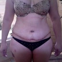 Day 5 and looking much better. Still pretty swollen.