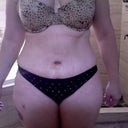 Day 5 and looking much better. Still pretty swollen.