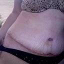 Day 5 and looking much better. Still pretty swollen.