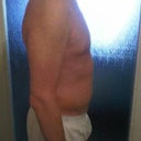 Day 6: Abdomen is swollen, but smaller and more contured then before