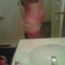 before my surgery2