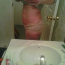 before surgery