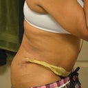 Really Swollen!