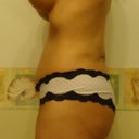 Other side