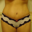 scar & undies