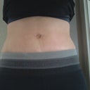 13 days, covered with yoga pants and still very swollen. I do like my belly button!