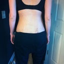 day 2 post surgery 24 hours