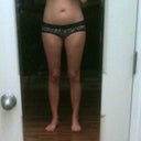 Front before surgery